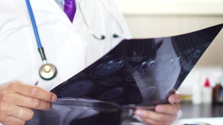 Doctor in hospital looking at CT or MRI scanの写真素材