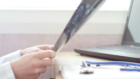 Medical doctor analyzing brain MRI scanの写真素材