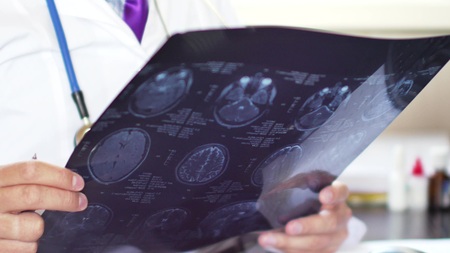 Doctor in hospital looking at CT or MRI scanの写真素材