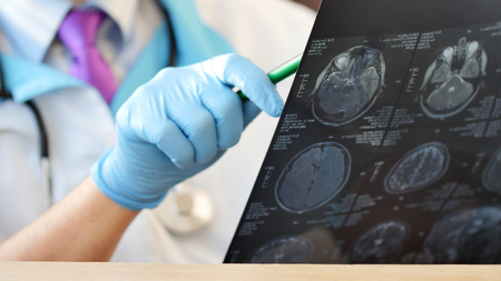 Doctor in hospital looking at MRI or CT scan of head.の写真素材