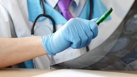 Doctor in hospital looking at MRI or CT scan of head.の写真素材