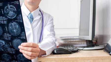 Doctor in hospital looking at MRI or CT scan of head.の写真素材