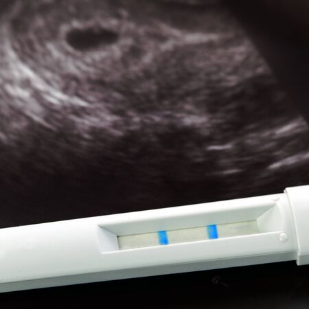 positive pregnancy test and ultrasound of baby in mother's womb close-up
