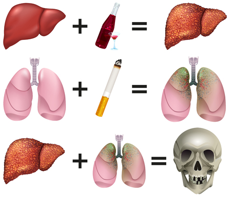 Alcohol and Smoking linked to premature Death in many Cancers. Human organs Liver, Lungs, Skull. Isolated on white vector concept illustrationのイラスト素材