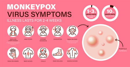 Monkeypox virus Symptoms. New cases of Monkeypox virus are reported in Europe and USA. Monkeypox is spreading in Europe. It cause skin infections. Monkeypox virus Symptom infographicsのイラスト素材