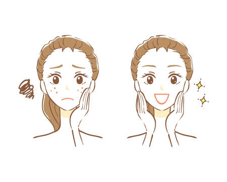 Illustration of before and after skin careのイラスト素材