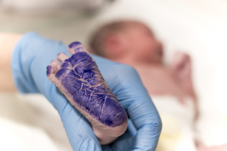 newborn baby footprint in hospital and blue ink overの写真素材