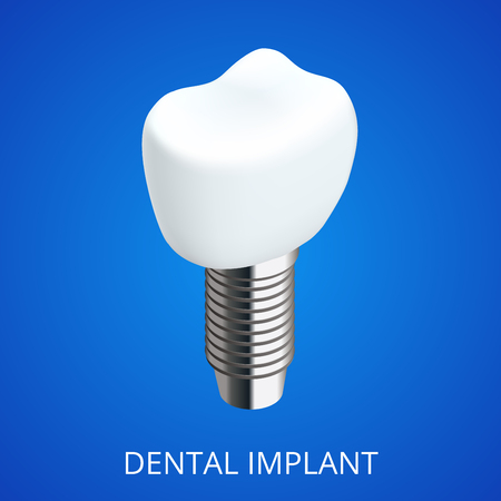 Isometric Tooth human implant. Dental concept. Human teeth or dentures. 3d illustration Isolatedのイラスト素材