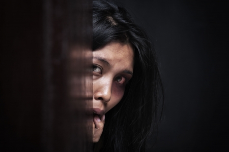 Injured woman hiding in dark, concept for domestic violenceの写真素材