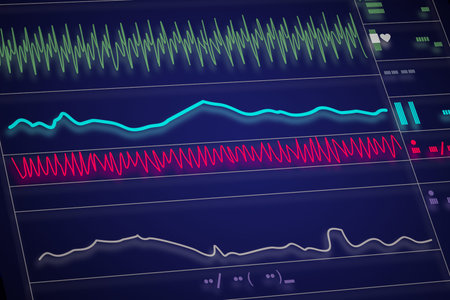Patient monitor showing vital signs ECG and EKG. Vector illustration.