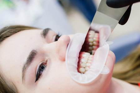 Bratislava, Slovakia - 12.29.2021. Dentist examining a patient's teeth in a dentist.