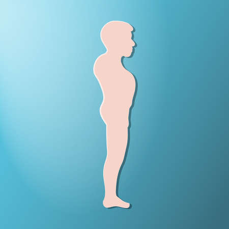 Acromegalia, acromegaly. Neuroendocrine disease. Pituitary gland disease. Silhouette of man, boy isolated. Vector illustration. EPS10.のイラスト素材