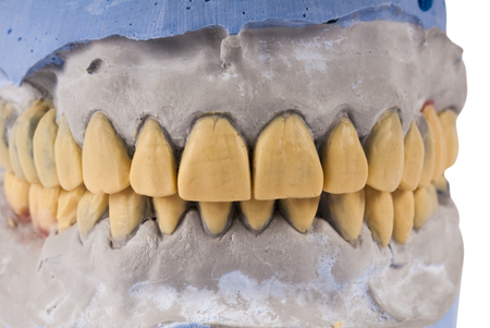 Ceramic dentures isolated on whiteの写真素材