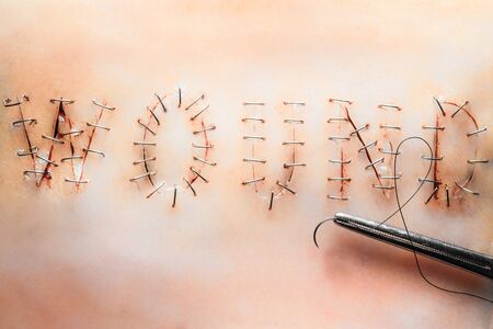 Surgical stitches, suture woundの写真素材