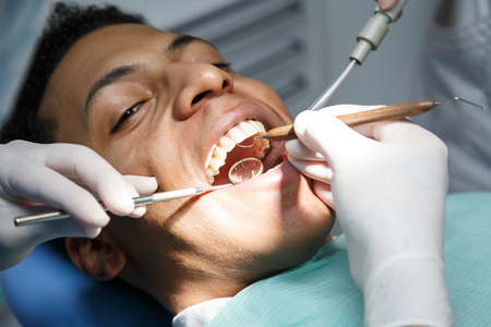 Dentist examining oral cavity of young African-American man working in in dental clinic with assistant.の写真素材