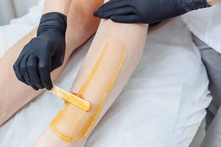 A hand in a black latex glove applies yellow wax to an unshaven leg. There are razor hairs on the leg. High quality photoの写真素材