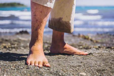 Mans lower legs with bumps and spots on the skin. Keratosis pilaris. Skin care conceptの写真素材