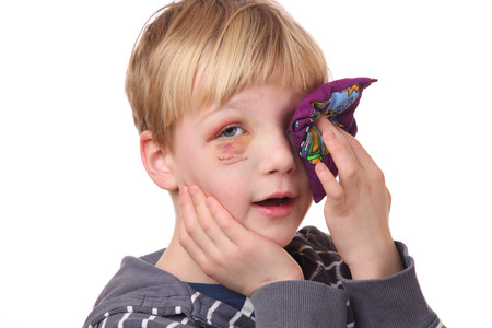 Portrait of a young boy with black eye on white backgroundの写真素材