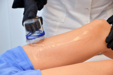 cosmetologist applying cream on female leg in spa salon, closeupの写真素材
