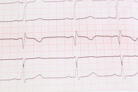 On photo cardiogram on paperの写真素材