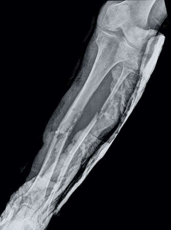 Abstract background. Monochrome texture. Image includes an effect with black and white tones.の写真素材