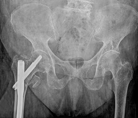 Toothbrush and toothpaste on a gray background. Copy space.の写真素材