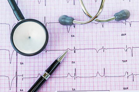 Stethoscope on electrocardiogram, ECG.の写真素材