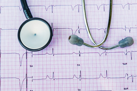 Stethoscope on electrocardiogram, ECG.の写真素材