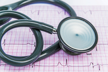 Stethoscope on the cardiogram backgroundの写真素材