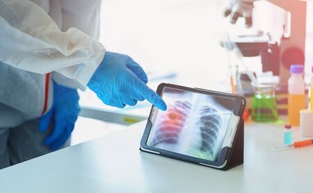 Scientist, Microbiologist or Doctor checking examining viral infection or pneumonia lesion on Chest...