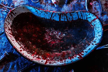 Unsanitary conditions in the hospital. Dirty blood stained medical utensils and tools. Copy space. Gloomy operating tableの写真素材
