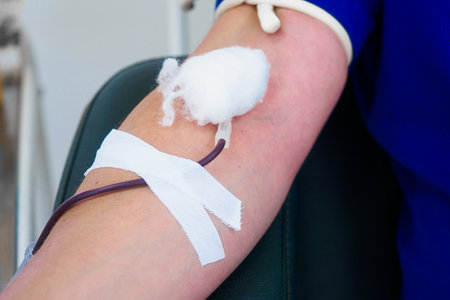 Donor donates blood from vein to blood transfusion station. Human hand with IV and needle close-up.の写真素材