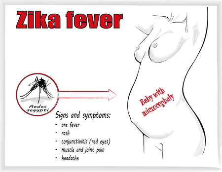 zika virus is dangerous during pregnancy. warning posterのイラスト素材