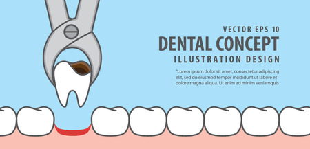 Banner Tooth Removal Illustration Vector On Blue Background