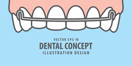 Banner Upper Hawley retainer illustration vector on blue background. Dental concept.のイラスト素材