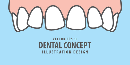 Banner Upper askew teeth illustration vector on blue background. Dental concept.のイラスト素材