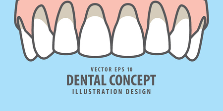 Banner Upper Recession gums illustration vector on blue background. Dental concept.のイラスト素材