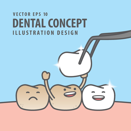 Square banner Teeth character very happy for putting new veneer on discolored tooth illustration vector on blue background. Dental concept.のイラスト素材