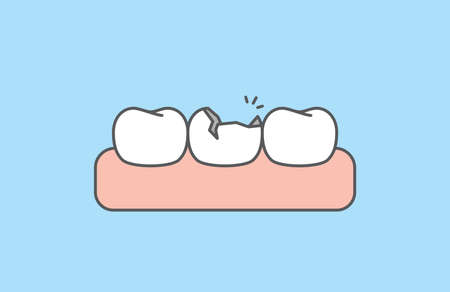 The broken tooth white teeth and gums illustration vector design on blue background. Dental care...