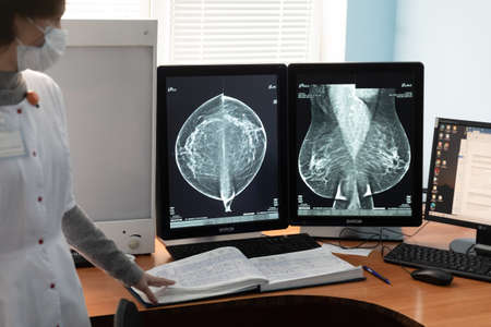 KYIV, UKRAINE - Oct. 20, 2021: Equipment for the consultative and diagnostic department of the Kiev City Cancer Center. Equipment for the diagnosis of breast cancer from the Poroshenko Foundationのeditorial素材