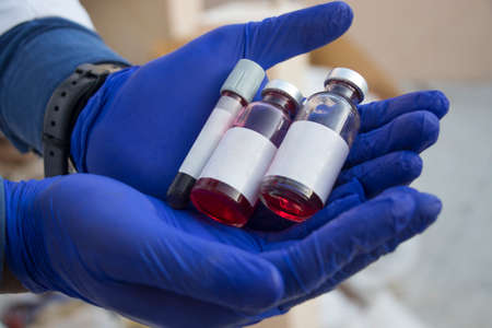 Close-up of a Hand Holding a Test Tube Filled with Bloodの写真素材