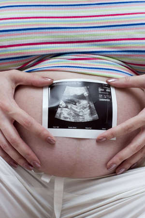 Close up of a pregnant woman's belly with sonogram