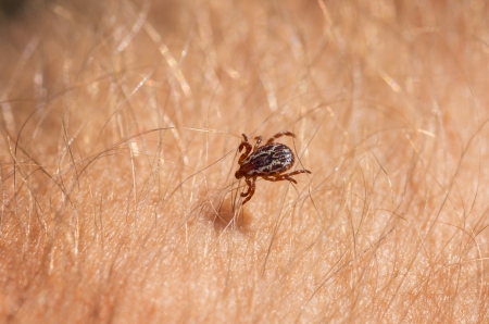 macro image of american dog tick on human arm