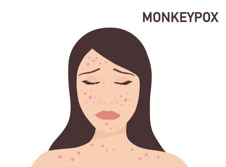 Young woman face with skin acne, pimples, blackheads vector illustration. Acne skin face problem...