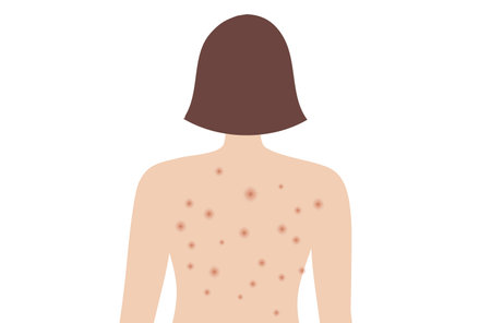 Acne on woman back. Allergy and Acne Skin Problems, Scratching her back vector illustrationのイラスト素材