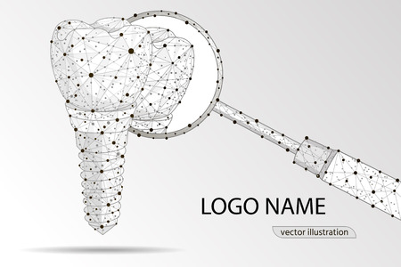 Vector illustration for dental clinic. dental implant. polygonal low poly design.のイラスト素材