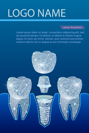 Healthy teeth and dental implant. Dentistry. Implantation of human teeth. Polygonal wireframe from dots and lines, abstract design. Digital graphics vector illustration. For Poster, Cover, Label, Sticker, Business Cardのイラスト素材