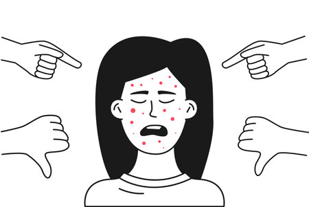 A teenager with acne on her face is subjected to ridicule. Bullying a child because of their appearance.のイラスト素材