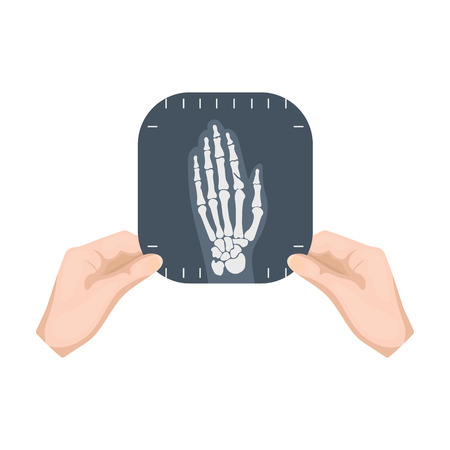 X-ray picture of the hand of a person in the hands of a radiologist. Medicine single icon in cartoon style vector symbol stock illustration web.のイラスト素材