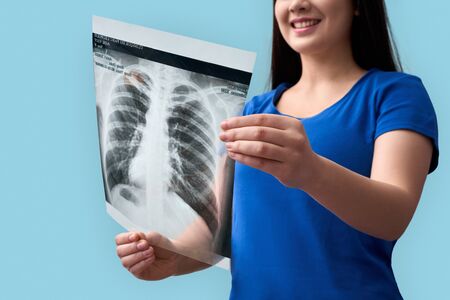 Cropped view of cheerful and happy young adult asian woman standing with x-ray picture in hands isolated on grey backgroundの写真素材
